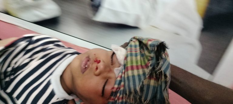 কাপ্তাই এ শিশু গুরুতর আহত