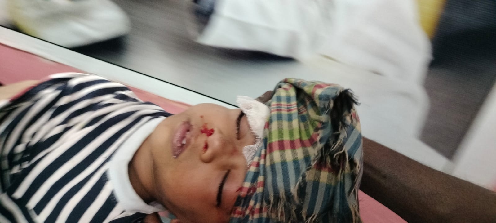 কাপ্তাই এ শিশু গুরুতর আহত