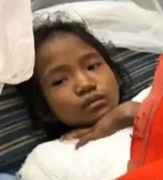 লক্ষীছড়ি উপজেলায় অগ্নিদগ্ধ শিশু নিশনা চাকমা