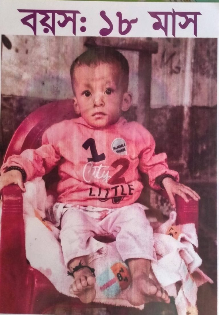 কাপ্তাইয়ে ১৮ মাসের মেশিংওয়াং-এর জীবন ঝুঁকিতে: হার্ট অপারেশনের জন্য দরকার ৪ লাখ টাকা